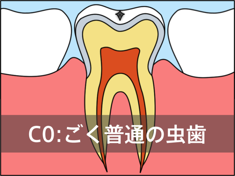 C0
