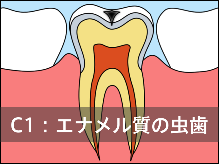 C1