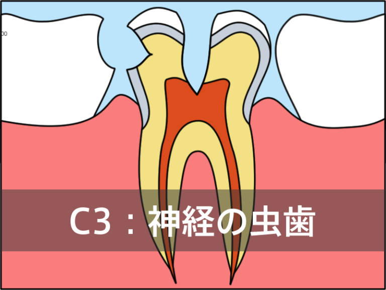 C3