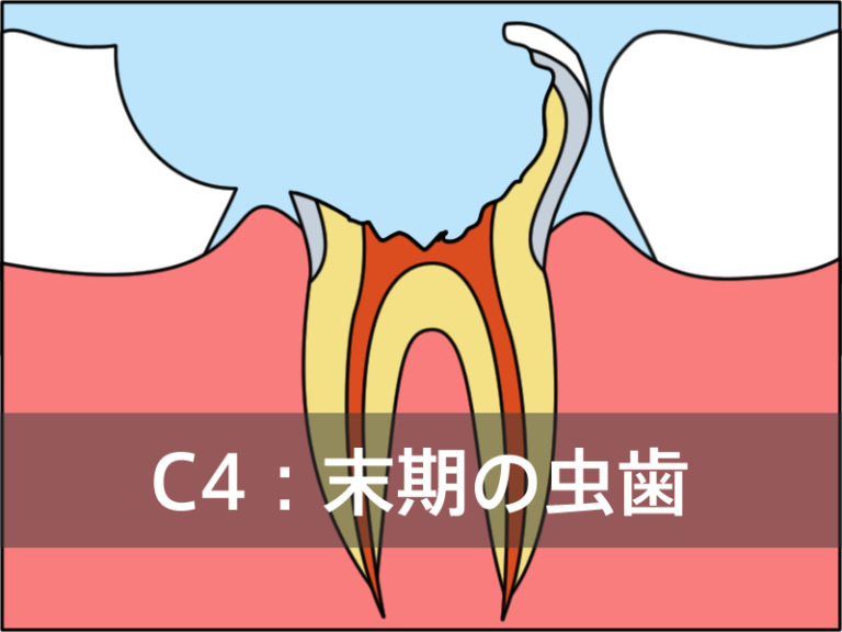 C4