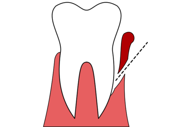 per005